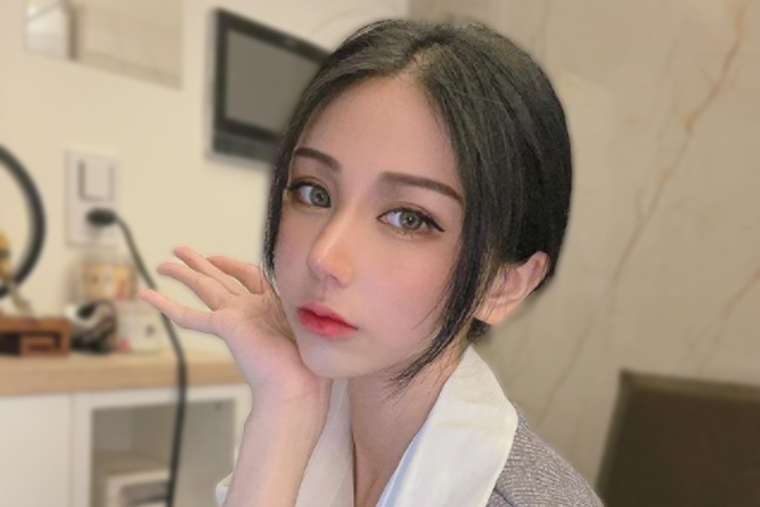 縮鼻頭與歪鼻矯正案例,縮鼻頭,歪鼻矯正,博恩妍